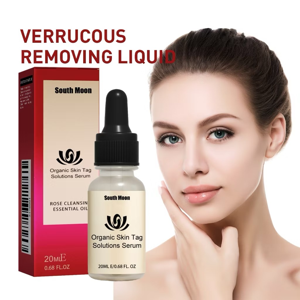 Penghilang Tahi Lalat Penghilang Kutil Skin Tag Remover Flek Dan Bintik Menghilangkan Pigmen Hitam K