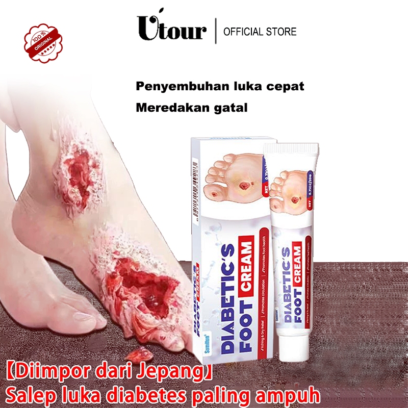 [2026 Edisi Terbaru ] 20g Luka baring Penyembuhan luka Luka diabetes Krim dekubitus Mengobati dekubi