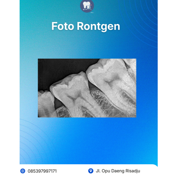 Paket Foto Rontgen + Konsultasi dokter