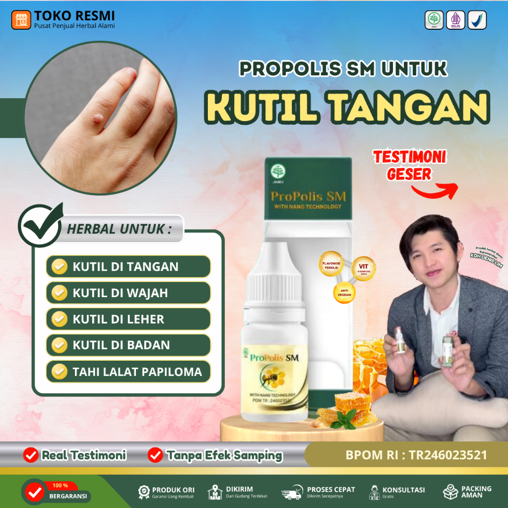 Obat Kutil Tangan, Tetes Papiloma skintag Penghilang kutil daging tumbuh di tangan / di tubuh, Peron