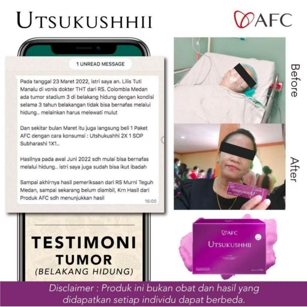 Sop subarashi ori japan AFC