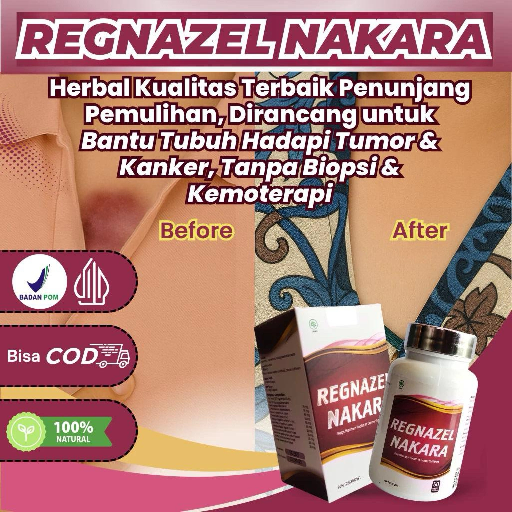 REGNAZELNAKARA - Obat Kanker Serviks - Tumor Rahim - kista Rahim - Benjolan