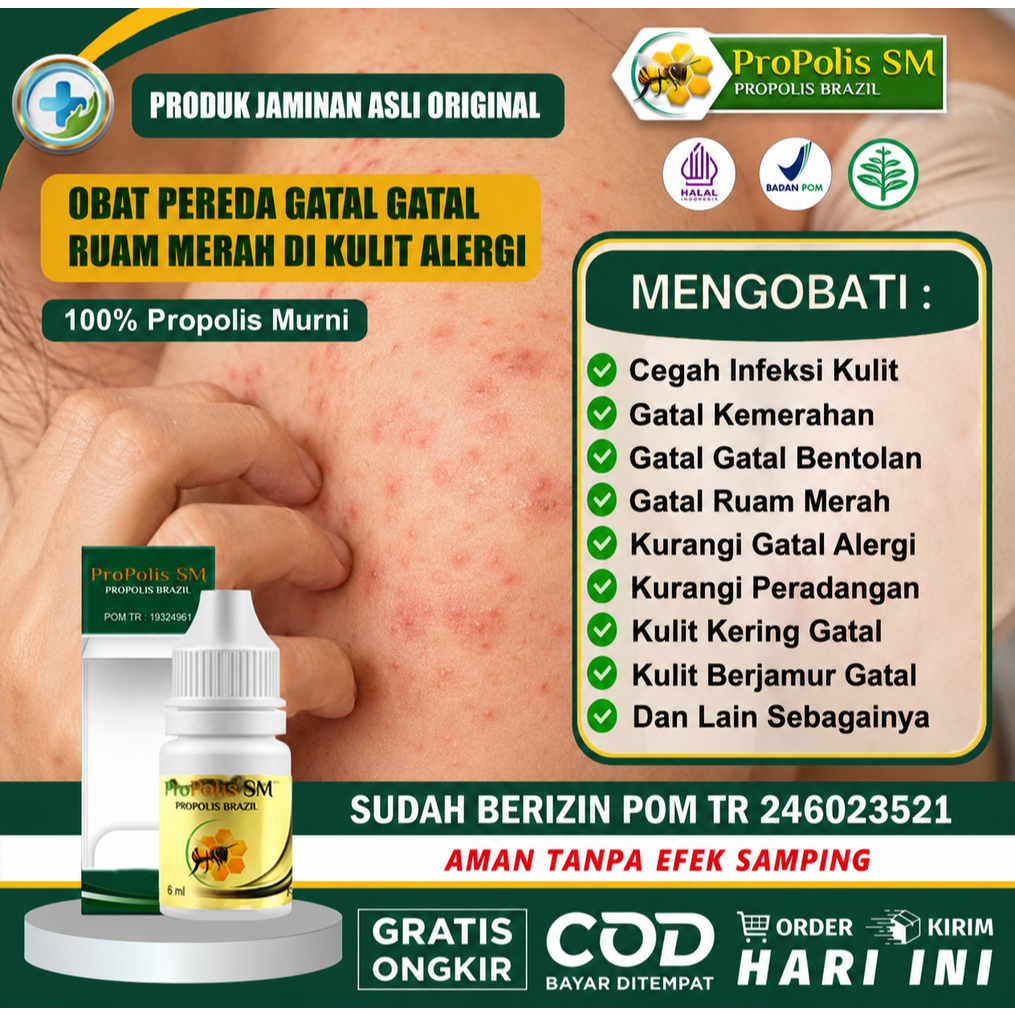 Obat gatal obat salep gatal caair propolis sm obat gatal kulit alami obat gatal di apotik untuk gata