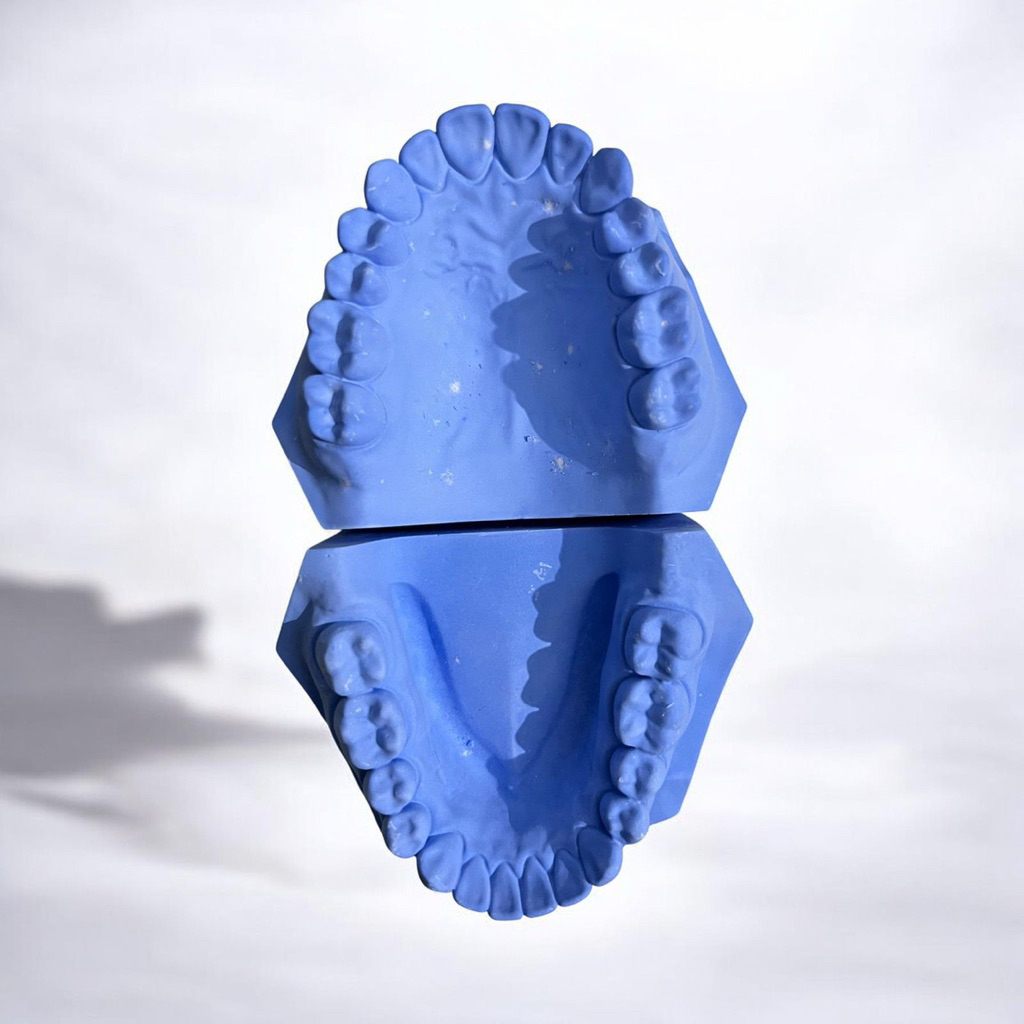 Dental model study gips / model gigi gips / gigi edentulous / model bergigi / model ompong/ model st
