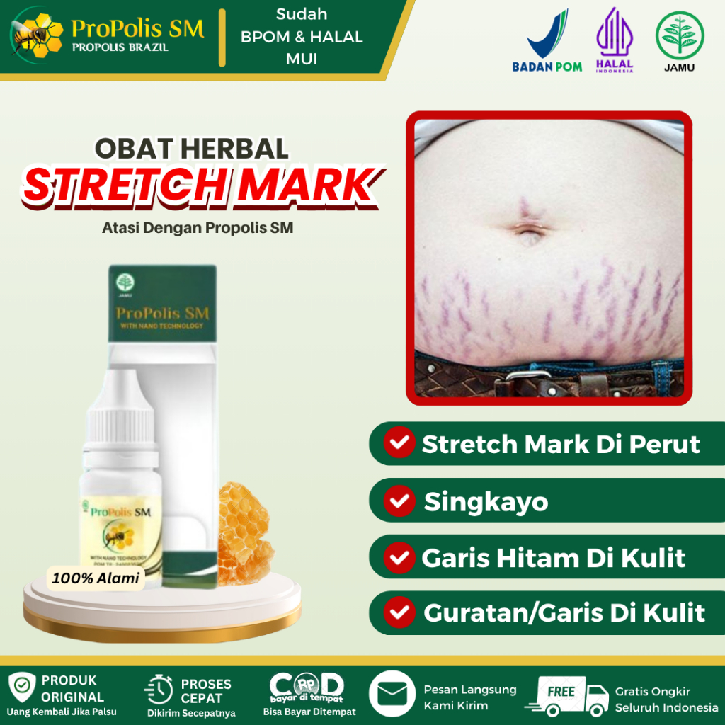 Obat Oles Stretch Mark Herbal, Stretch Mark Di Perut, Paha, Leher, Betis, Guratan/Garis Di Kulit, Pe