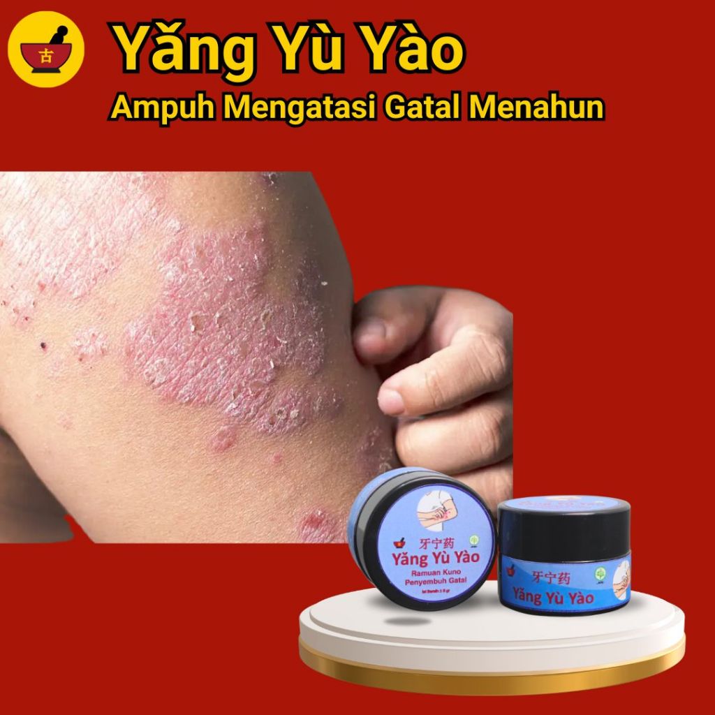 Yǎng Yù Yào Obat Gatal Cina Tradisional Ampuh Atasi Gatal Menahun