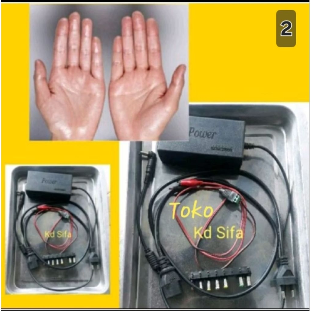 Alat Terapi Therapy Ionto Keringat Kringat Berlebihan Di Telapak Tangan Dan Telapak Kaki Atau Hiperh