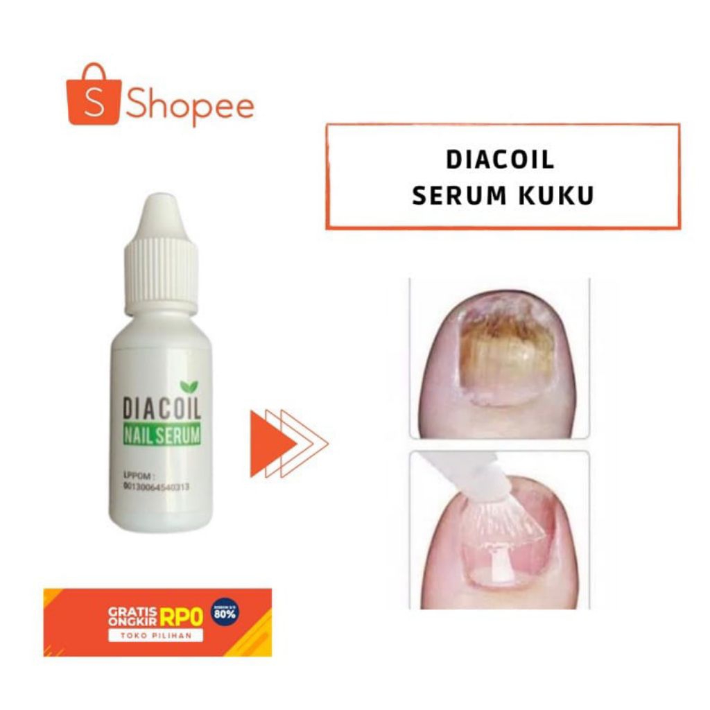Diacoil Nail Serum 15ml Original Penghilang Kuku Cantengan Rusak Bernanah Patah Kutikula Nail Art Pe