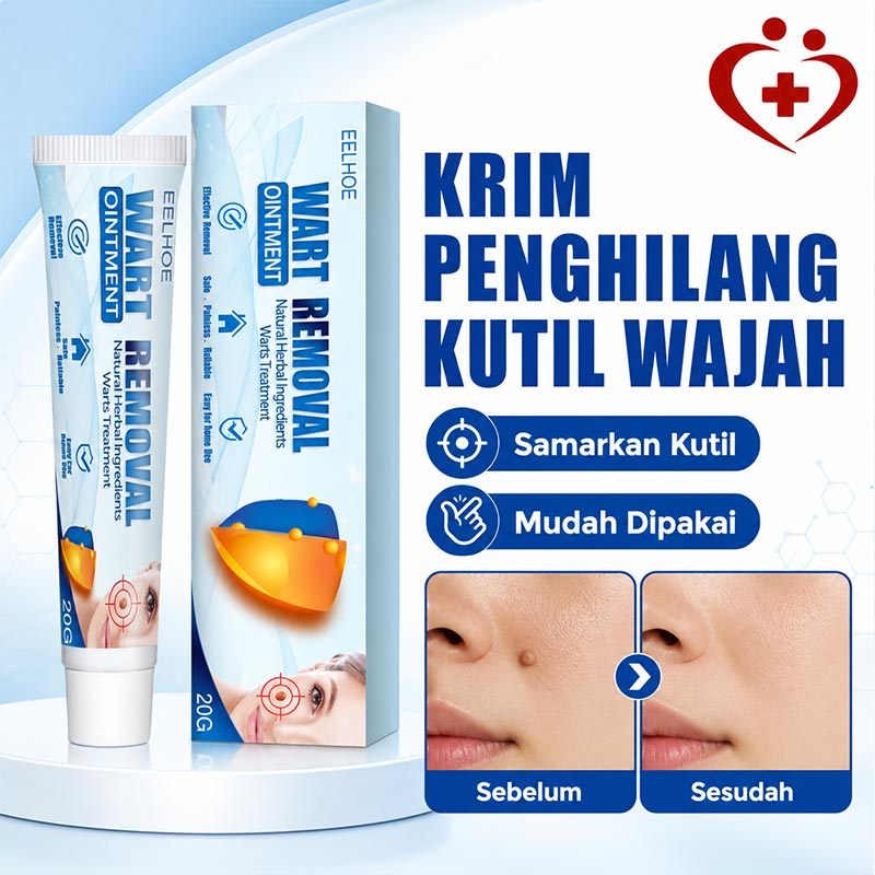 OOUWA Krim Penghilang Kutil Wajah / Penghilang Tahi Lalat dan Kutil / Obat Penghilang Kutil / Salep 