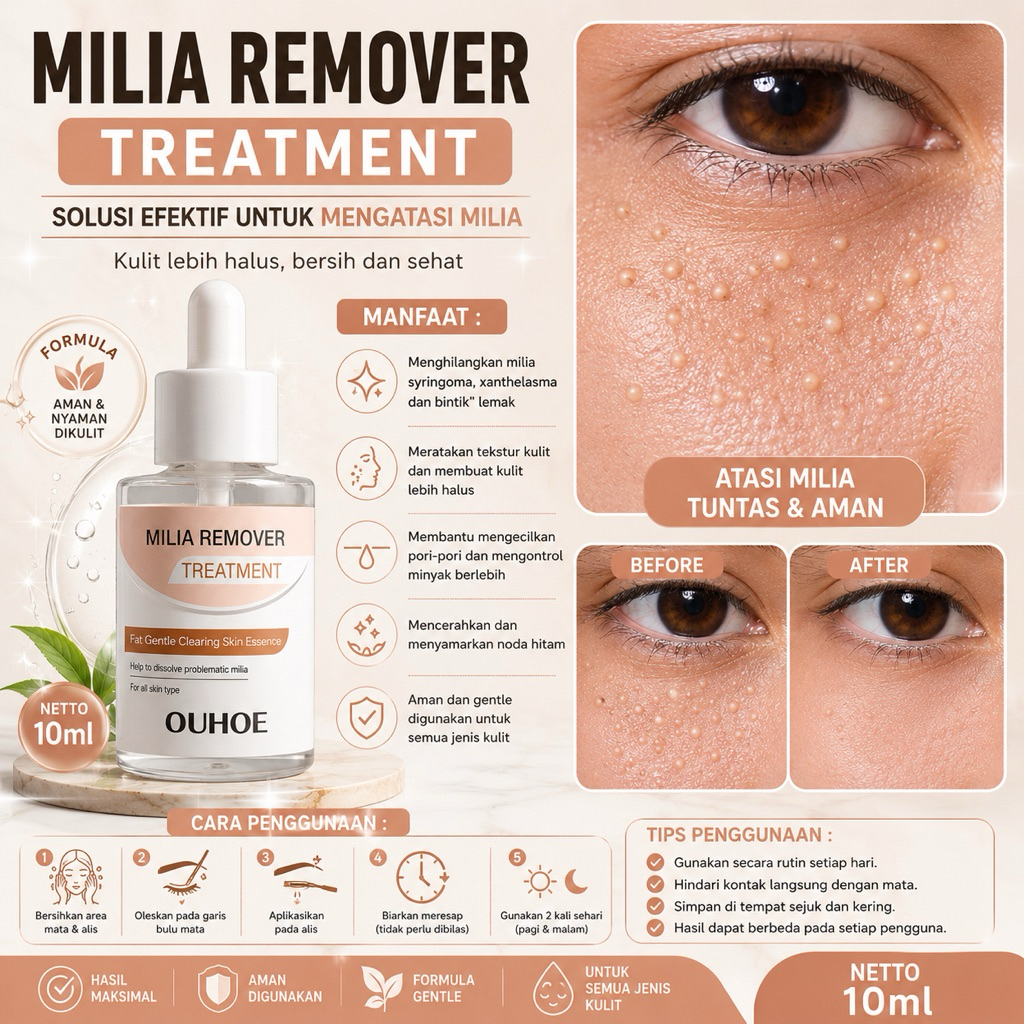 Milia remover serum penghilang perontok milia bintik putih mata Ouhoe Milia Remover Treatment Oil-Fr