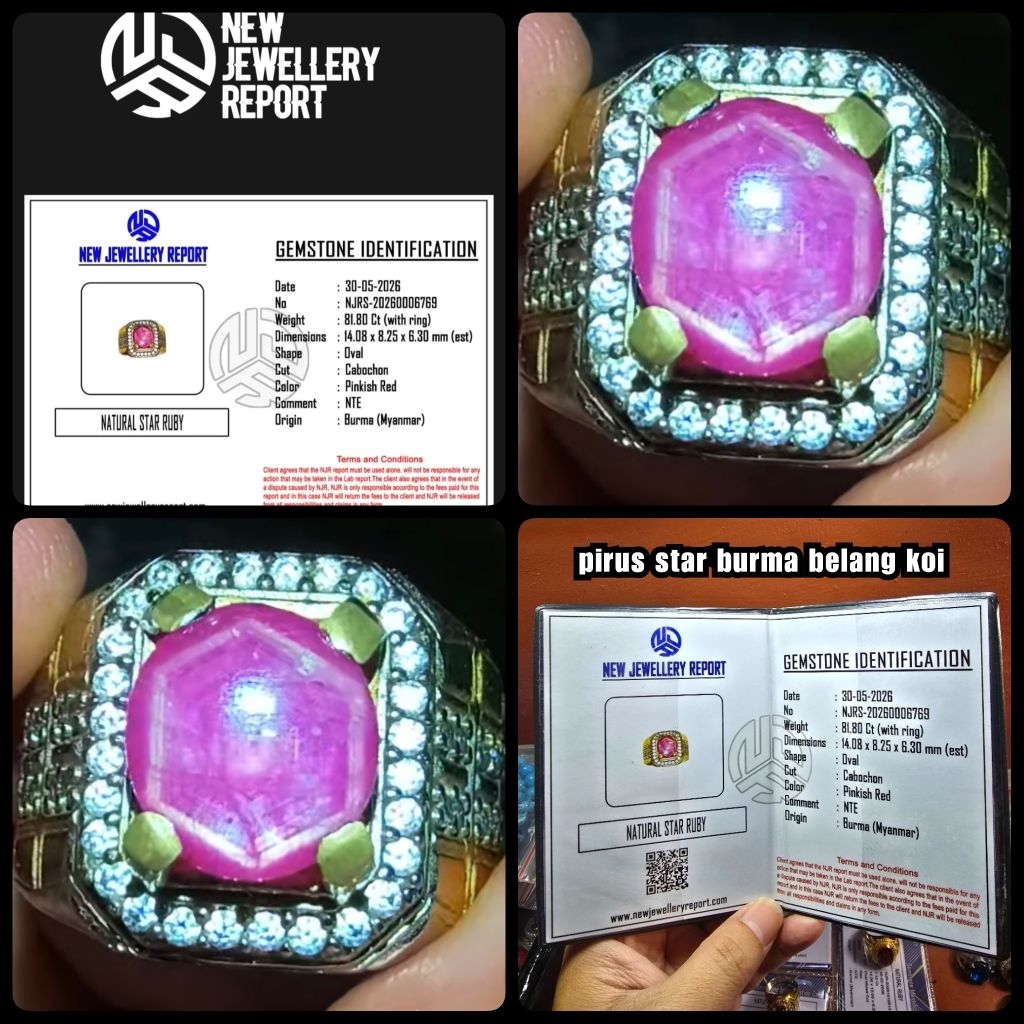 Cincin ruby burma star burma belang koi patkwa ya ( NTE )