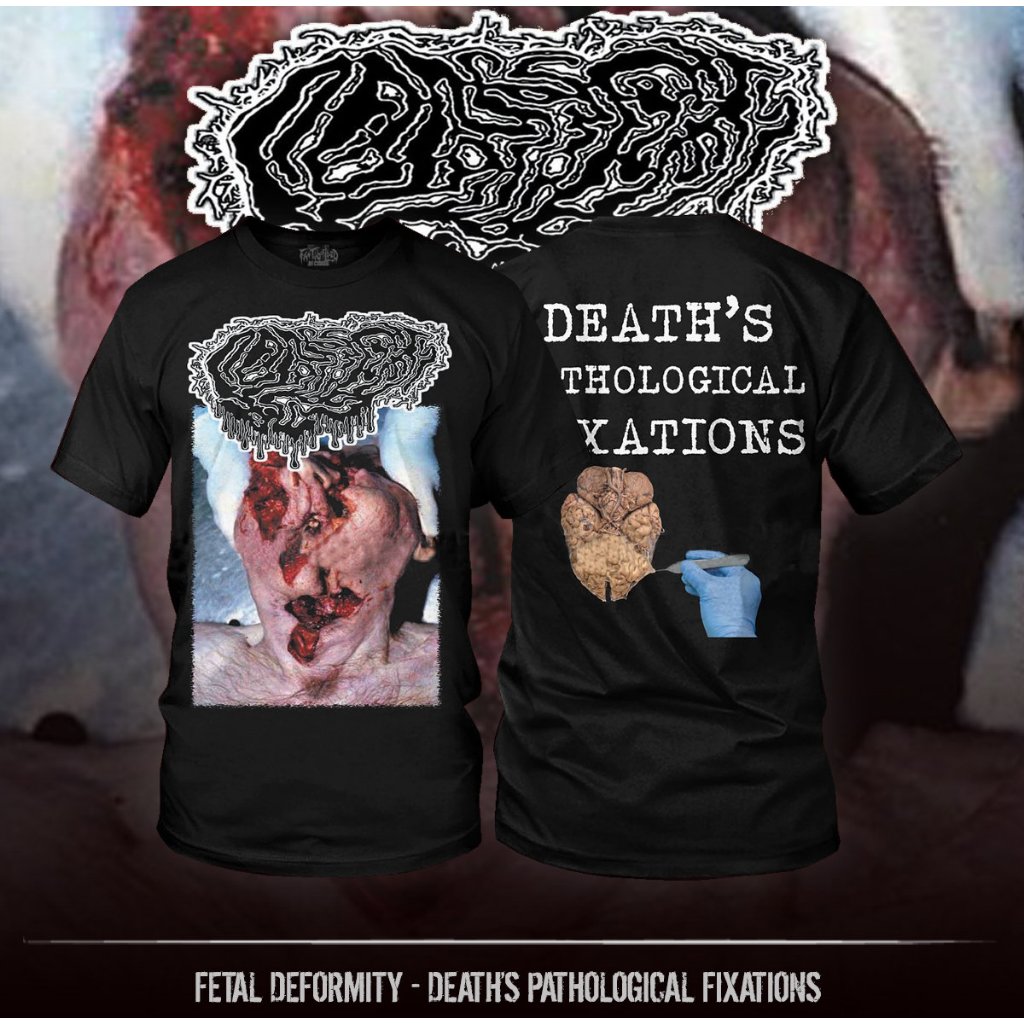TS – FETAL DEFORMITY – Deaths Pathological Fixations