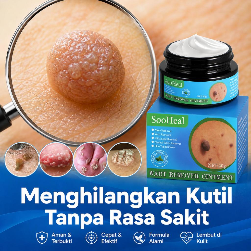 [TERLARIS] Penghilang kutil Salep kutil paling ampuh Salep kutil Obat penghilang kutil Salep kutil
