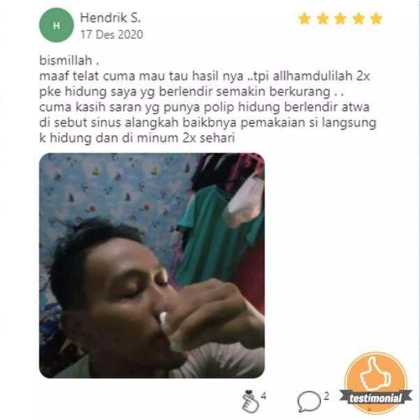 OBAT SAKIT GIGI, POLIP GIGI, POLIP PULPA TERBUKTI