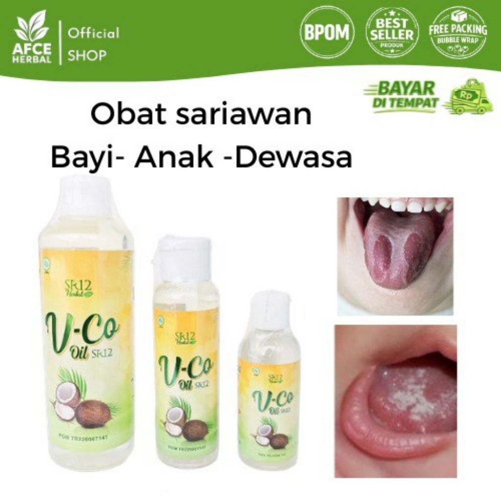 AMPUH MENYEMBUHKAN SARIAWAN ANAK OBAT SARIAWAN / OBAT AMANDEL OBAT SAKIT GIGI