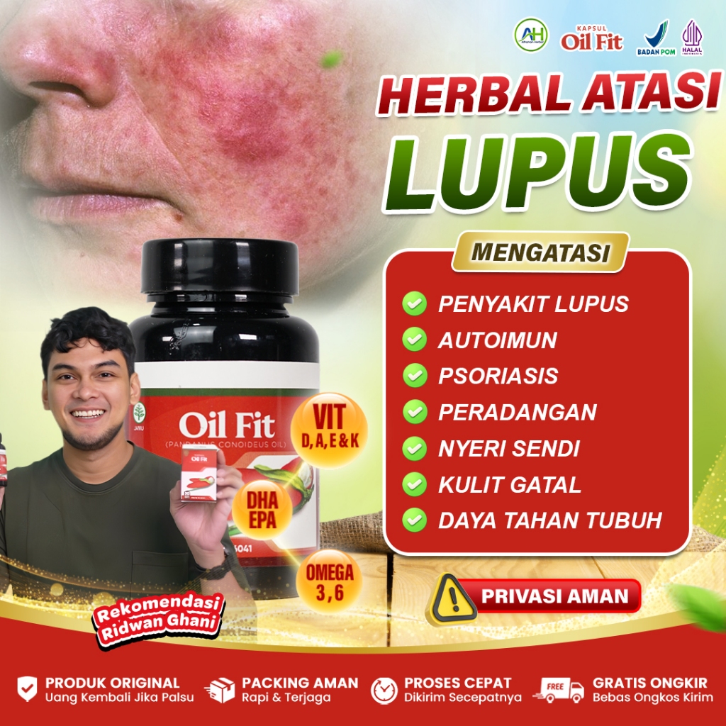 Obat Lupus, Autoimun, Ruam Kulit, Wajah Kemerahan, Psoriasis, Nyeri Sendi - Oil Fit 50 Kapsul Asli