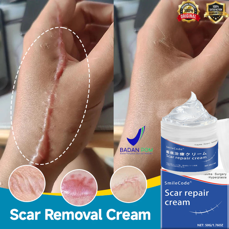 [100%efektif]Salep keloid paling ampuh salep penghilang bekas luka penghilang bekas luka hitam koren