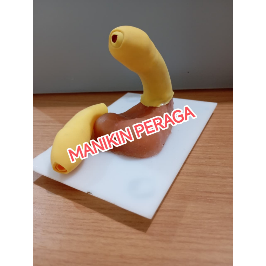 Kulit Sirkumsisi 2 lapis. Manikin Sirkumsisi dengan kulit sirkumsisi 2 Lapis