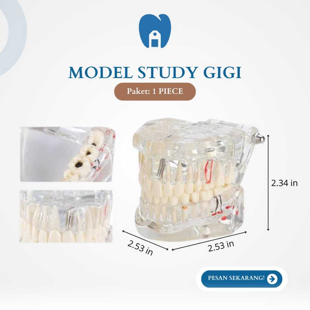￼Dental model study gigi / edukasi transparan studi ) implant phantom crown karies bridge bening imp