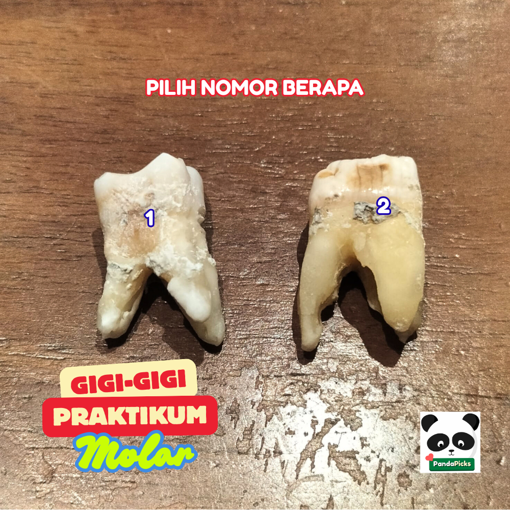 Gigi Molar / Gigi Geraham / Gigi Praktikum Asli