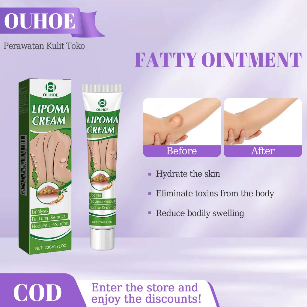 OUHOE Lipoma Cream 20g Cream Lipoma Menghilangkan Lipoma Salep Benjolan Untuk Benjolan Kepala Dan Ki