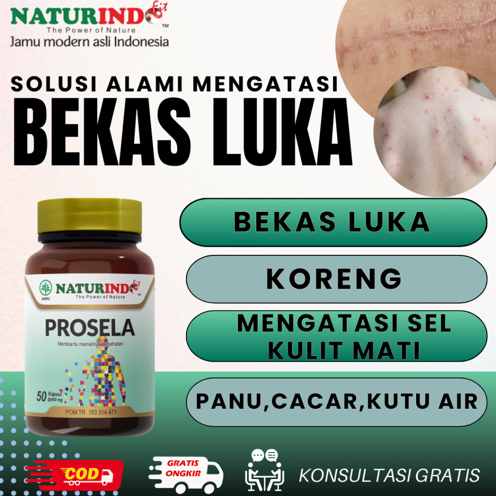 PROSELA - NATURINDO Obat Menghilangkan Bekas Luka Jerawat Koreng Borok Menghitam Paling Ampuh