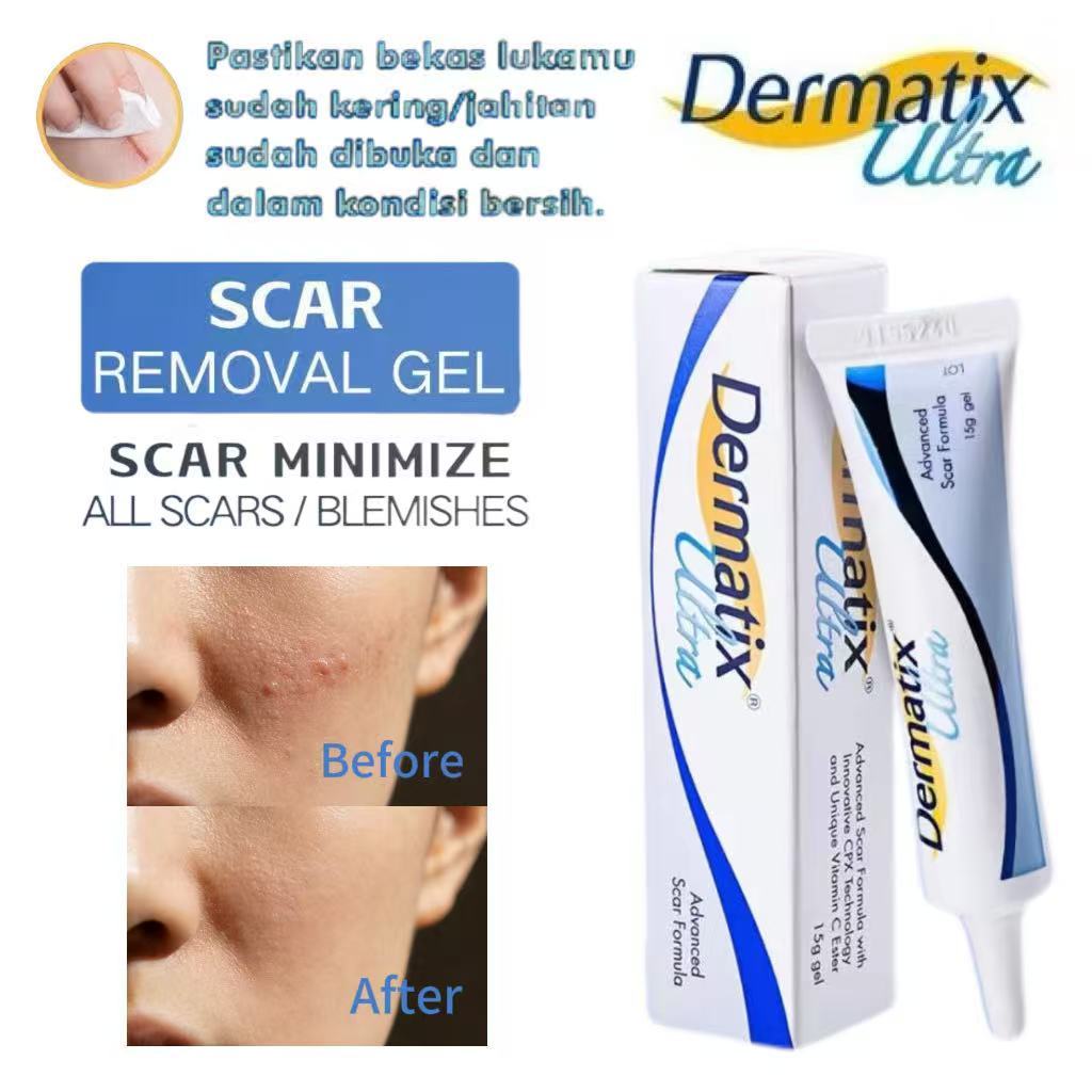 [ ORI & EXP 2028 ] Dermatix Ultra Cream Penghilang Bekas Luka 15gr  / Mencerahkan Pigmentasi Bekas L