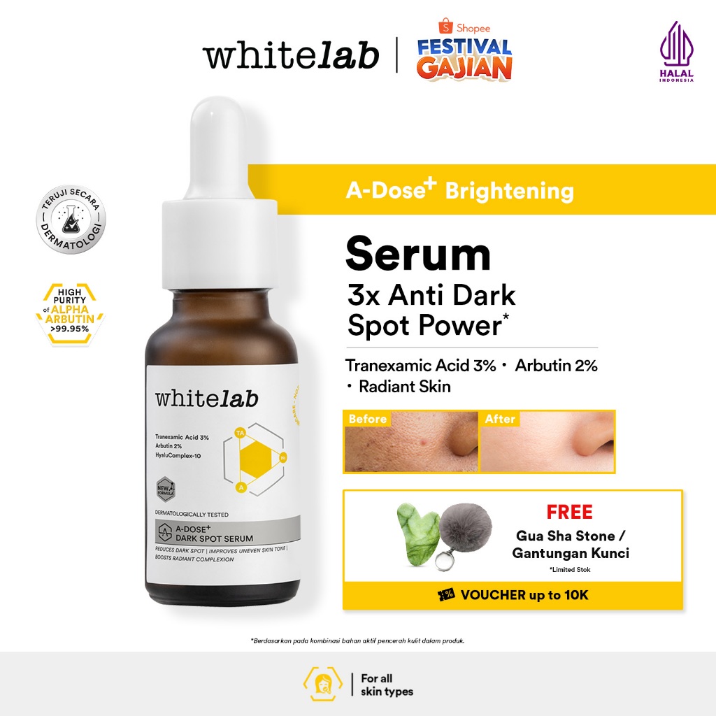 Whitelab Serum Arbutin Anti Dark Spot Flek Hitam - Serum Glowing Pencerah Wajah Bekas Jerawat