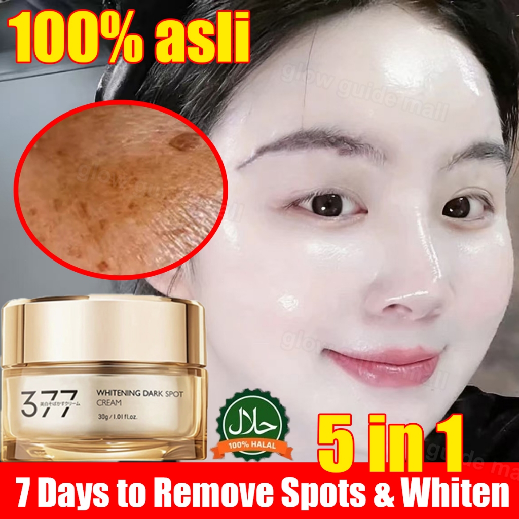 377 cream penghilang flek hitam cream melasma flek hitam membandel cream pemutih wajah glowing cepat