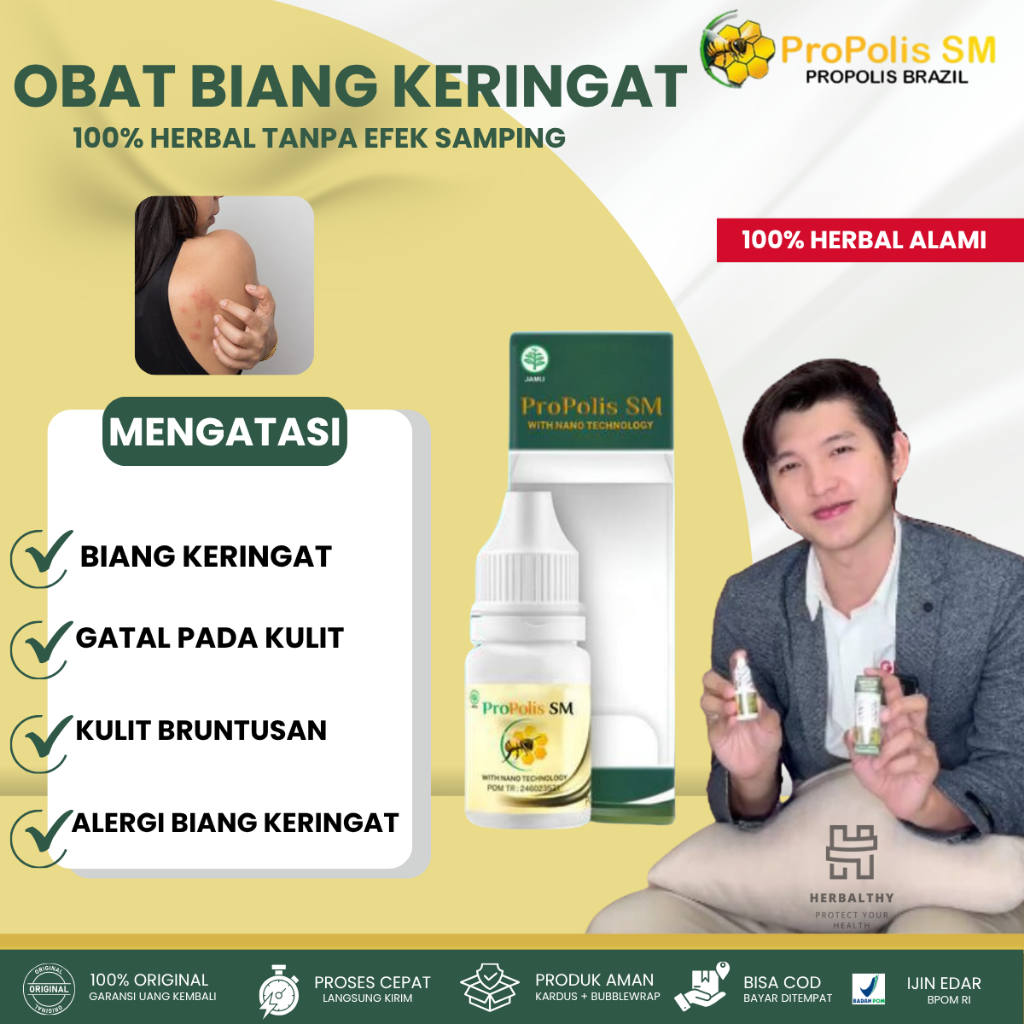 Obat Oles Biang Keringat Dewasa, Obat Oles gatal alergi biang keringat, Obat Oles Biang Keringat Gat