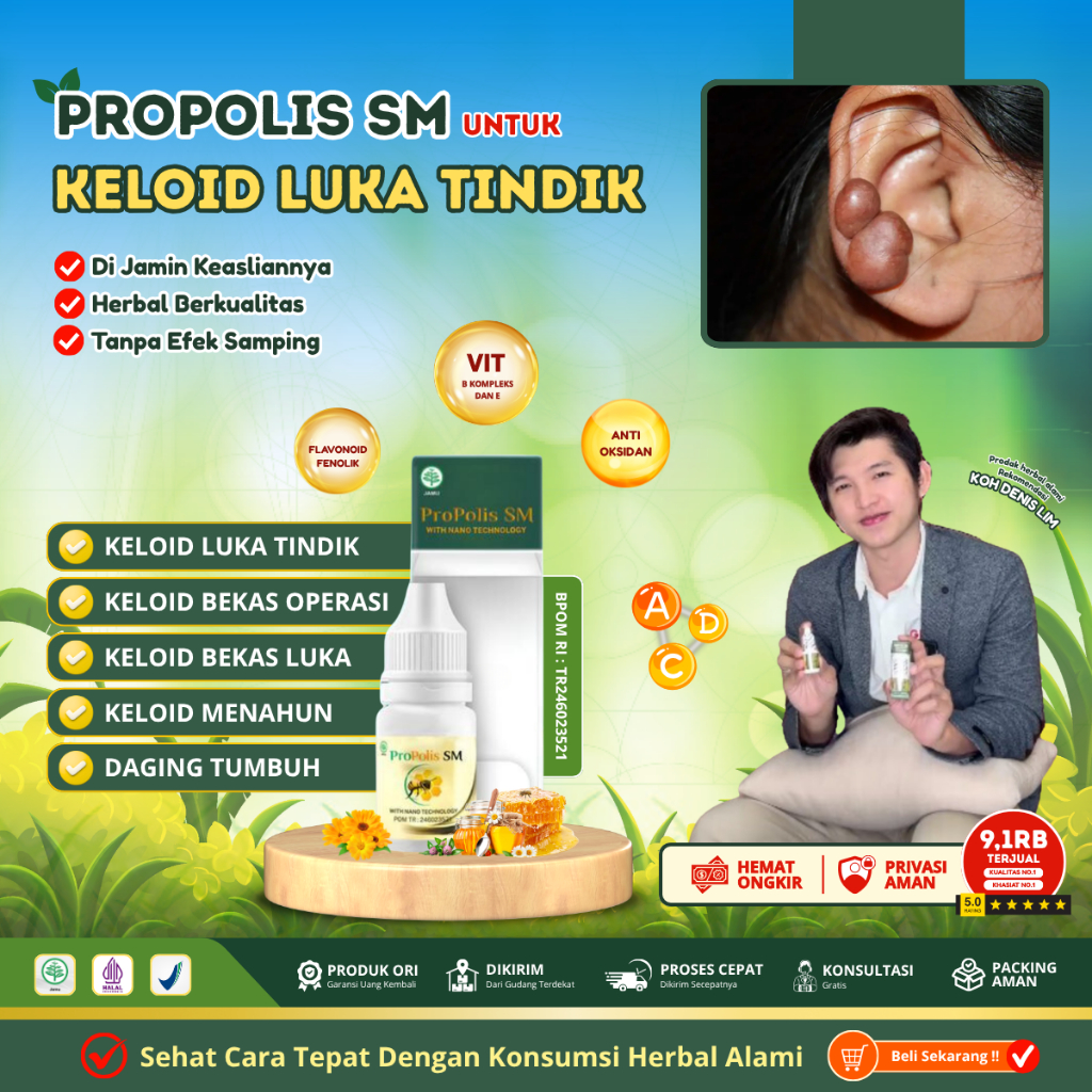 Obat Keloid Bekas Tindik , Penghilang Keloid Bekas luka di Telinga, Obat daging tumbuh di Telinga
