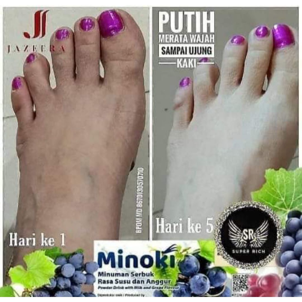 Minoki