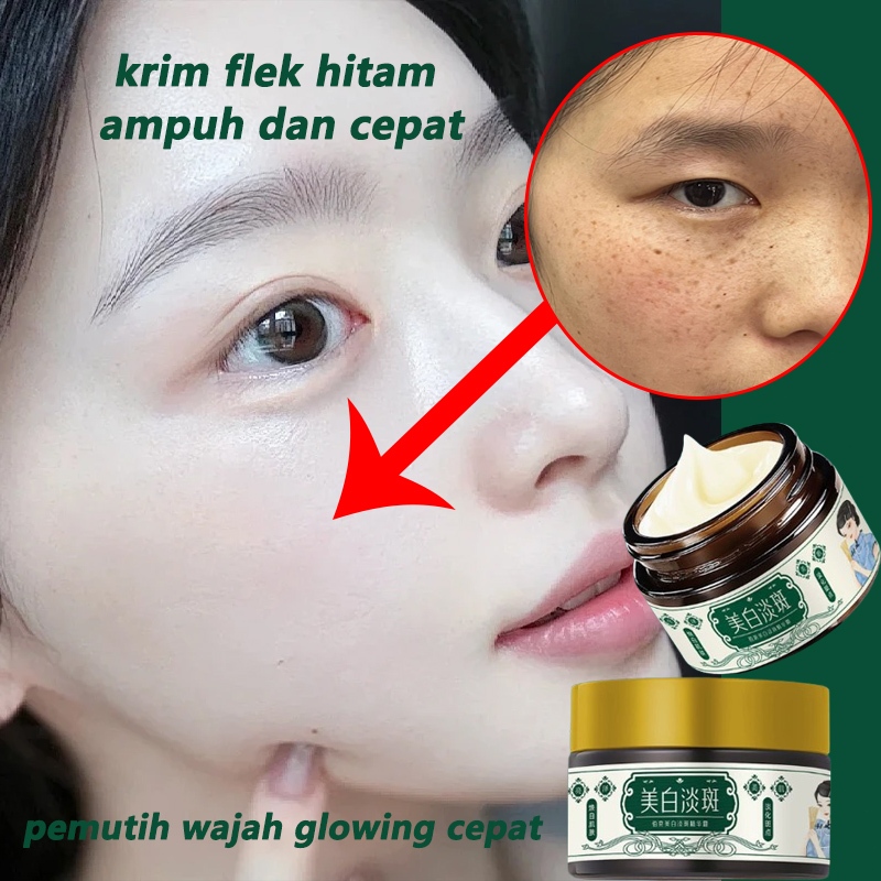 Krim Flek Hitam Ampuh Dan Cepat  Pemutih Wajah Glowing Cepat Cream Penghilang Flek Hitam Membandel K