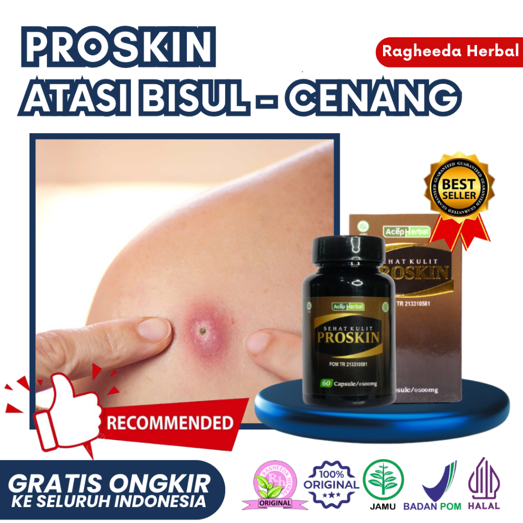 Obat Bisul Bisulan, Cenang di Sela Sela Jari Tangan, Benjolan Berisi Nanah, Penyakit Furunkel, Karbu