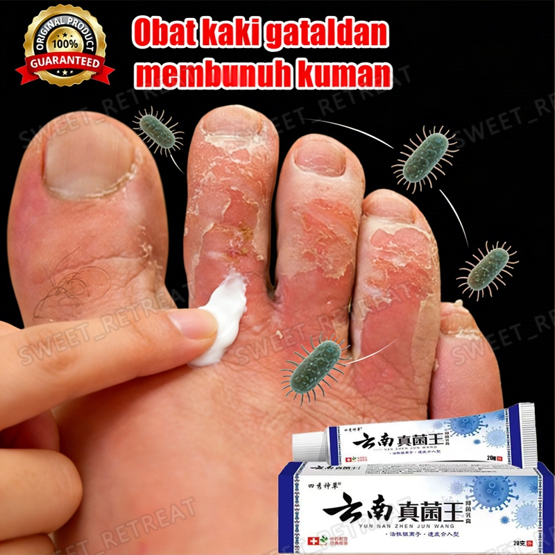Obat Kaki Rayapan Dan Bau oba gatal kulit gatal paling ampuh yunan baiyao original salep jamur kulit