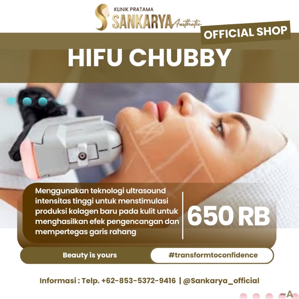 SANKARYA AESTHETIC HiFi Chubby