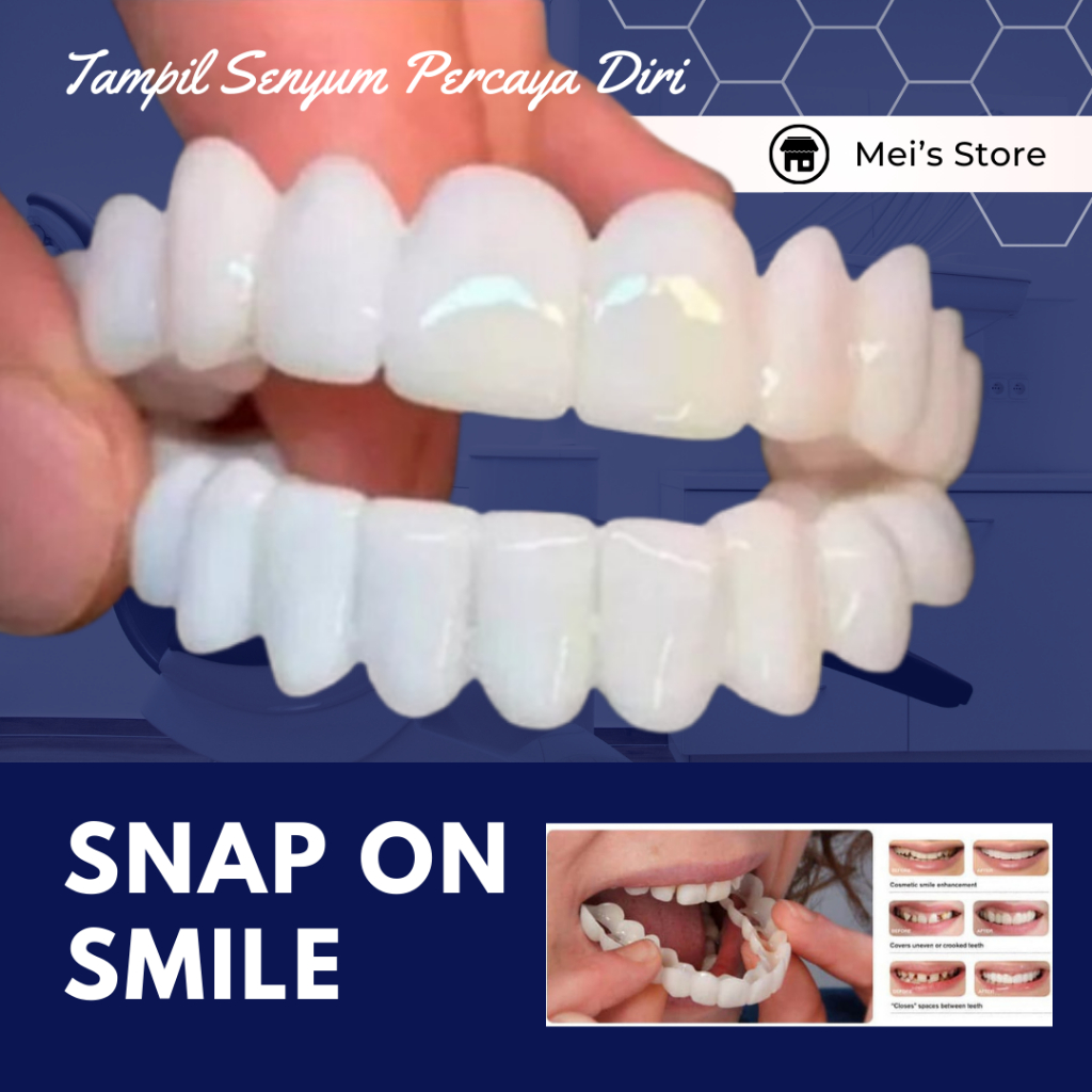 PROMO Snap On Smile Gigi Silikon 100 % Original Snap On Smile 1 Set