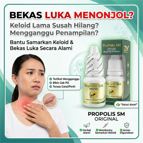 Obat Penghilang Keloid Yang Sudah Lama, Obat Keloid Menahun, Salep Untuk Keloid, Penghilang Bekas Lu