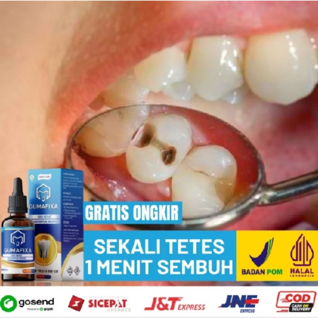 Obat Sakit Gigi Berlubang (Bolong) - GUMAFIXA Original - Paten Mengobati Gigi Nyeri & Ngilu