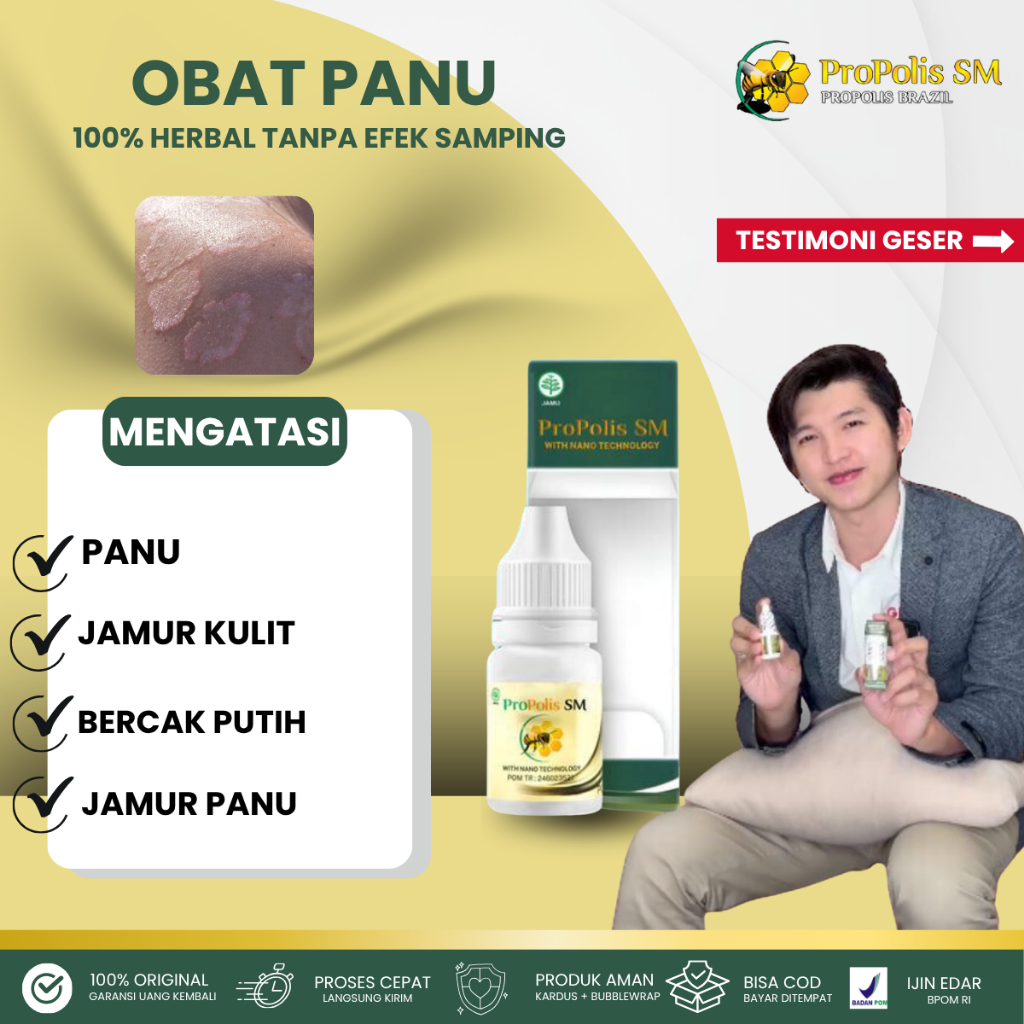 Obat Oles Panu Di Wajah, Leher, Punggung - Salep Penghilang Panu Hapur, ProPolis SM PALING AMPUH NAM