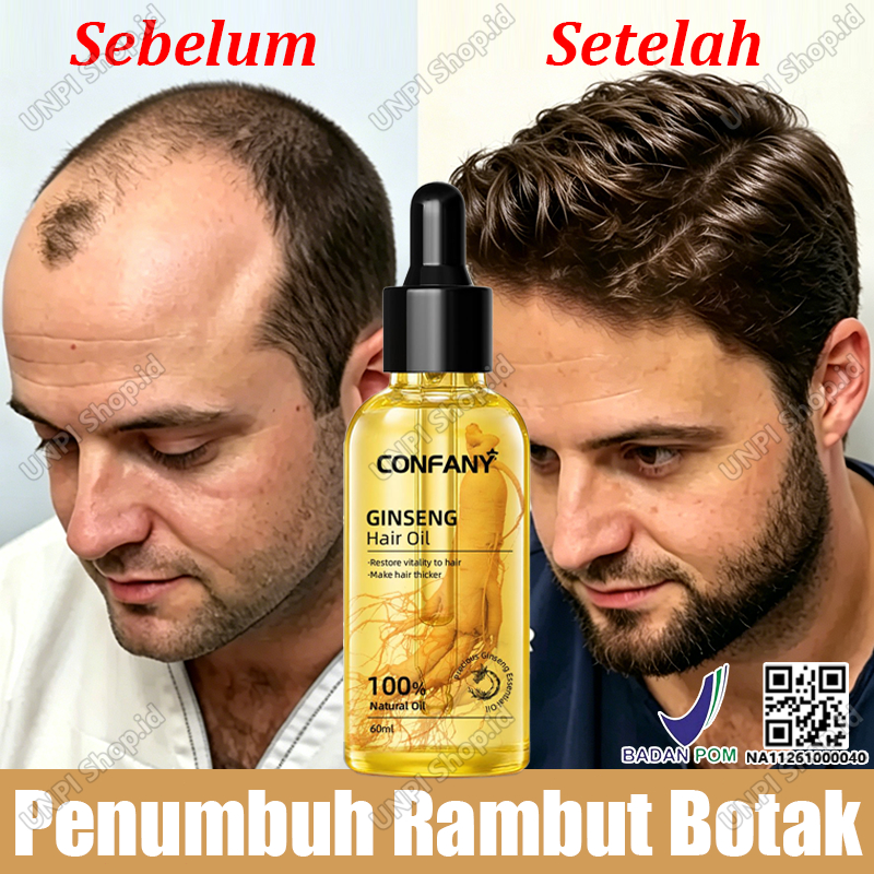 Minyak Penumbuh Rambut Ginseng untuk Rambut Botak dan Rontok