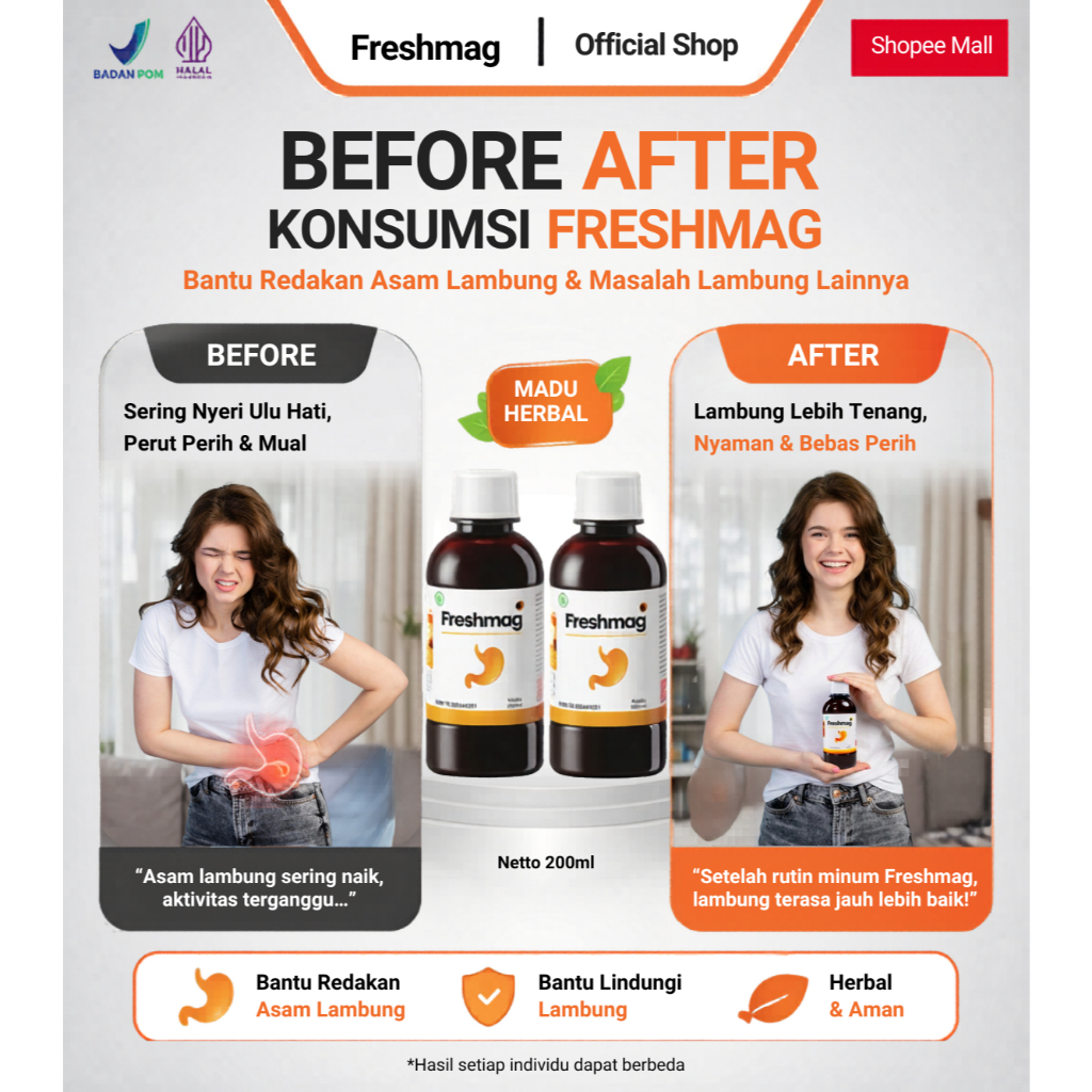Freshmag Madu Lambung Asli - Ampuh Atasi Permasalahan Asam Lambung Maag dan GERD / Obat Lambung Maag