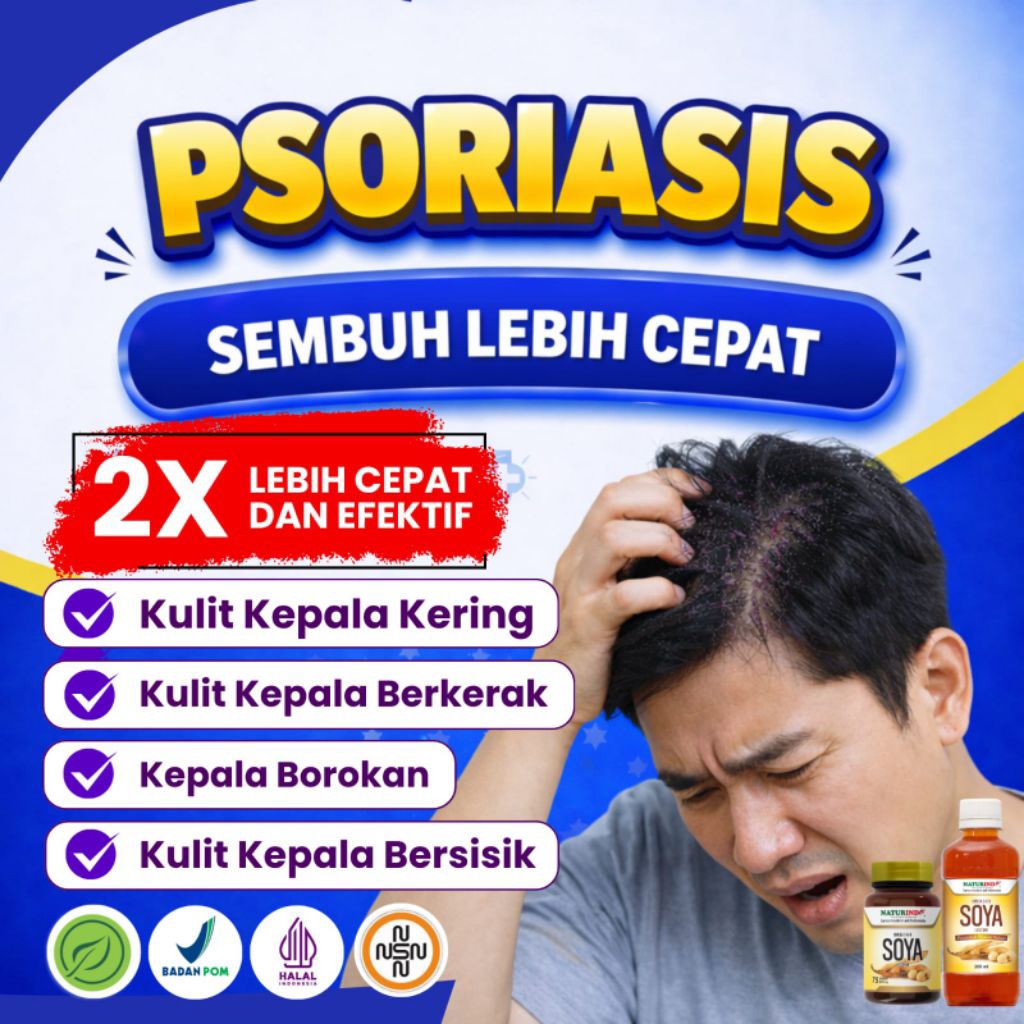 Obat Psoriasis Kulit Bersisik Berkerak Ketombe [HERBAL]