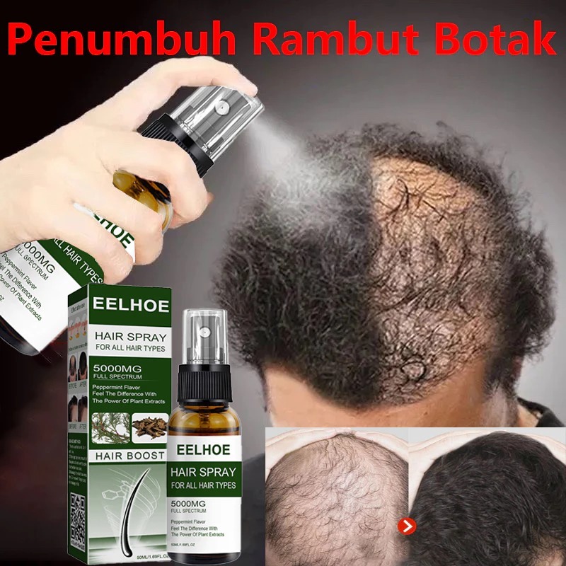 Penumbuh Rambut Botak Semprotan Penumbuh Rambut Obat Rambut Botak Serum Penumbuh Rambut Hair Growth 