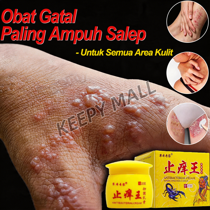 Salep Gatal Kulit Jamur Paling Ampuh Salep Eksim Kering Dan Gatal Oba Gatal Paling Ampuh Salep Gatal
