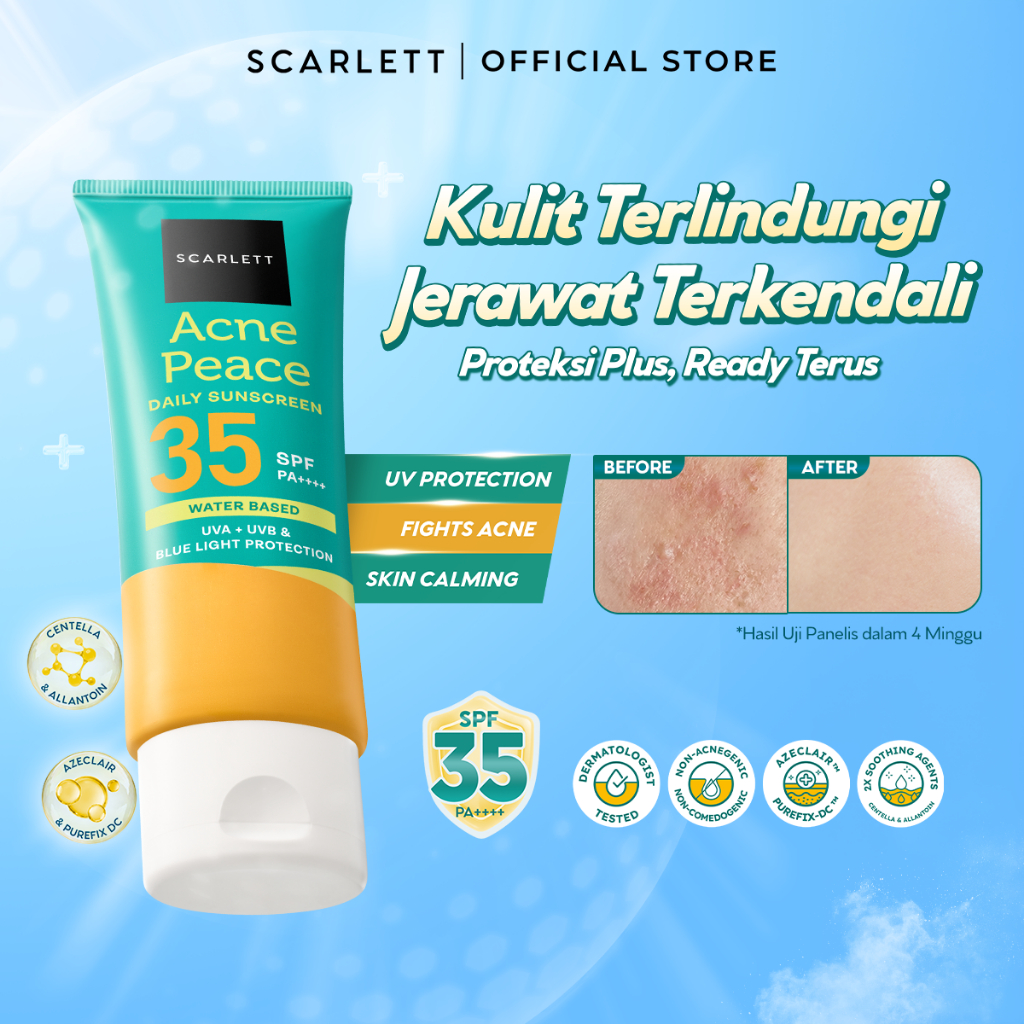 SCARLETT Acne Peace Daily Sunscreen SPF 35 PA++++ – Sunscreen Kulit Berjerawat , Teruji In Vivo , No