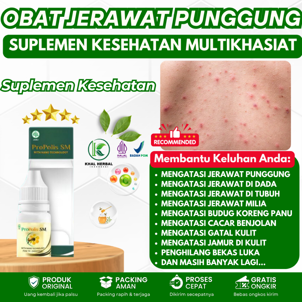 Obat Jerawat punggung, Penghilang Jerawat Punggung, Salep Jerawat punggung, Obat jerawat badan, Obat