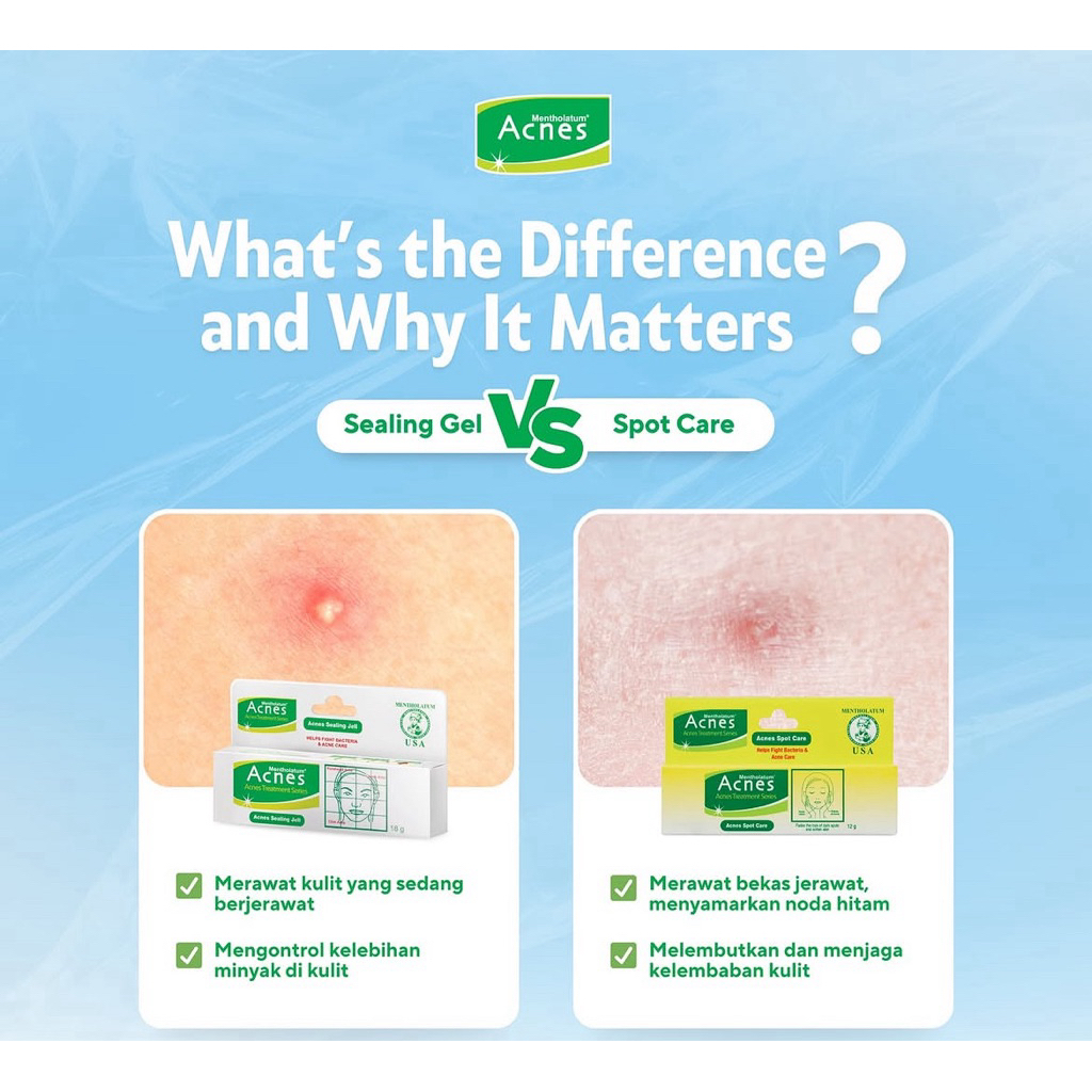 acnes sealing gel & spot care