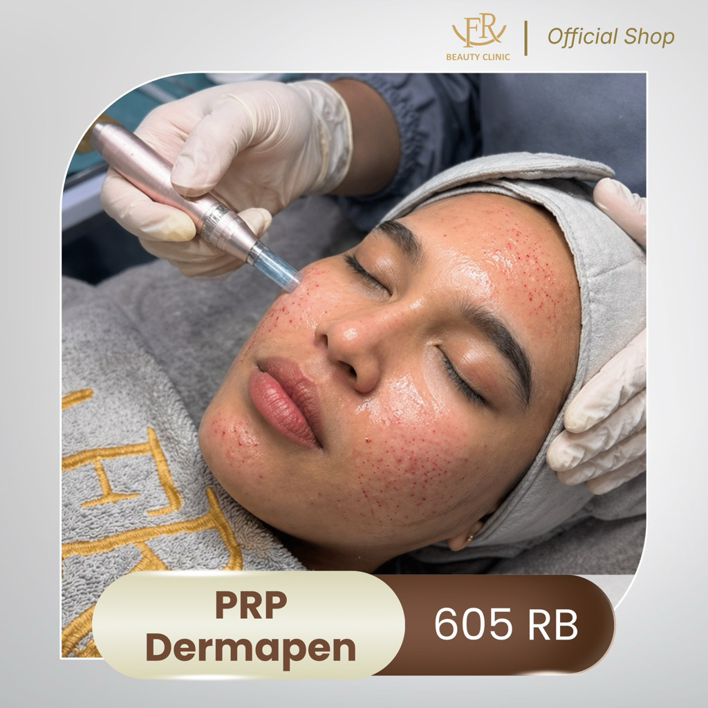 FR Beauty PRP Dermapen Treatment