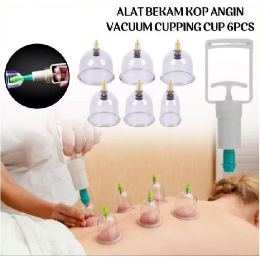 Kop Angin 6 Pcs Alat Kop Bekam 6 Cup Alat Terapi